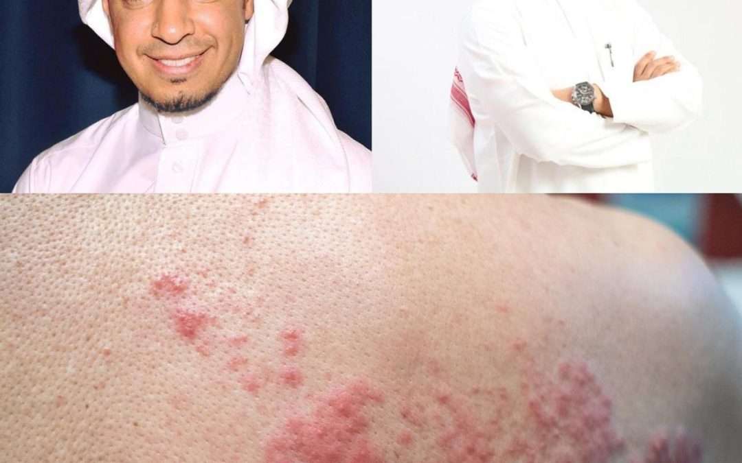فعاليات توعوية تزامنًا مع الأسبوع العالمي للحزام الناري لرفع الوعي وتصحيح المفاهيم الخاطئة