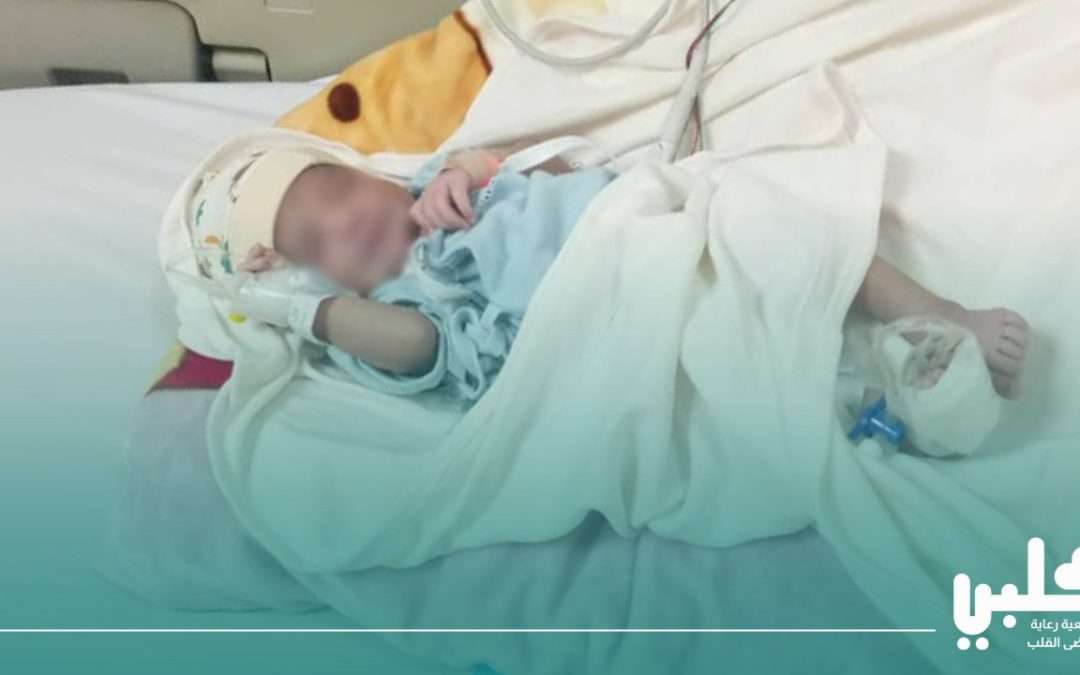 جمعية “قلبي” تنقذ طفلاً رضيعاً بعمر يومين في عملية طوارئ عاجلة